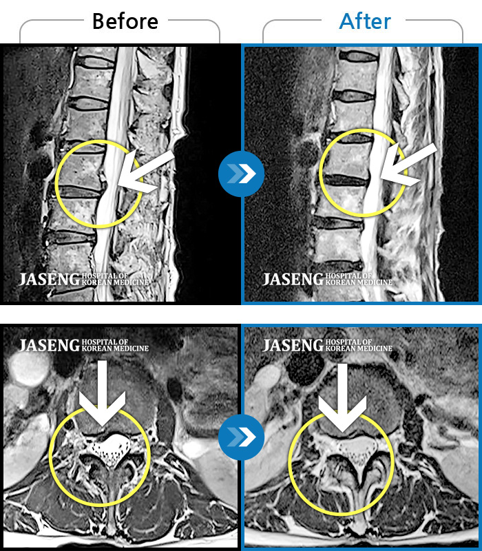 뱸ڻѹ溴 ġ MRI  ġ-    ְ  ڼ ص .