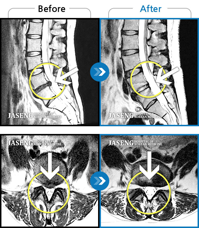 ȭڻѹ溴 ġ MRI  ġ-㸮  , ٸ ٱ   ߴ. 