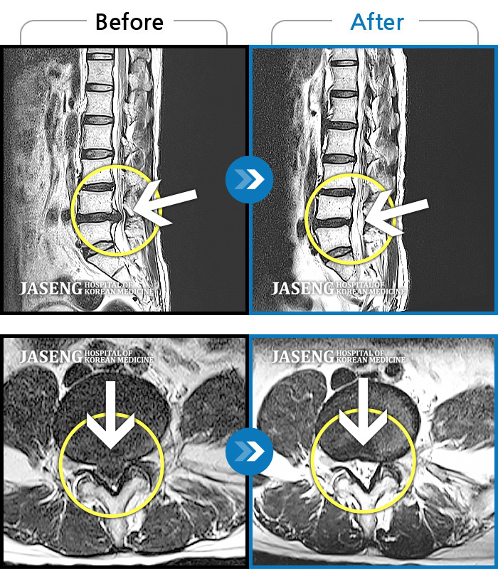 뱸ڻѹ溴 ġ MRI  ġ-ɱ  ٸ   ǰ ϴ  ̴   ߴ.