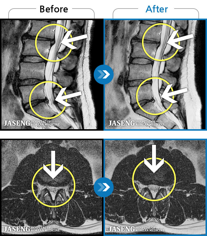 ڻѹ溴 ġ MRI  ġ-  ߲  ߻ 㸮    ,     ٷ  ߻