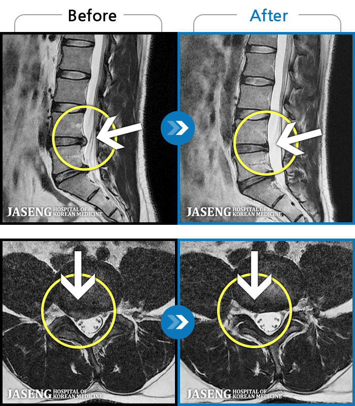 λڻѹ溴 ġ MRI  ġ- 㸮 㸮 ̸   ִ.