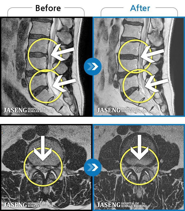 õڻѹ溴 ġ MRI ġ- 㸮 Ͽ ȴ ͵ · ϼ̽ϴ.
