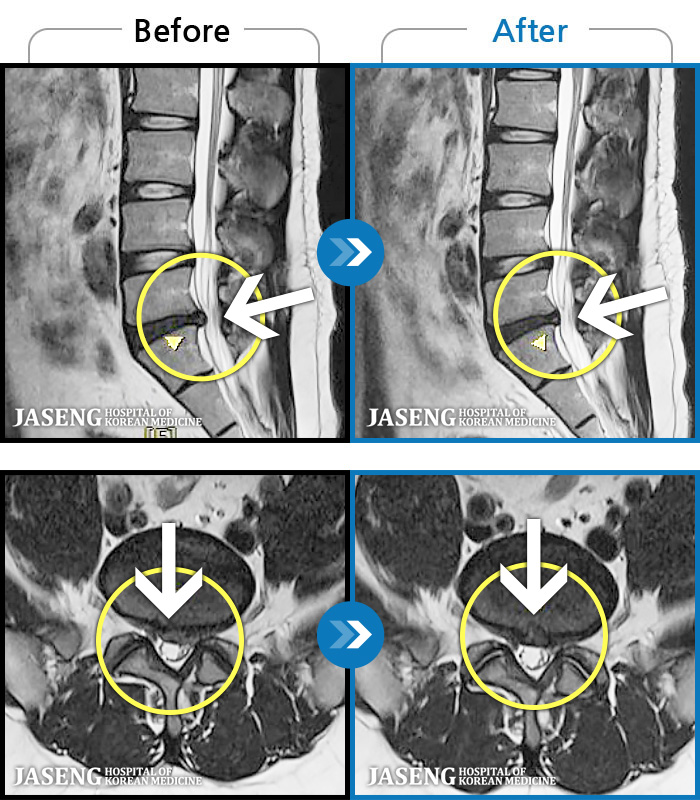ڻѹ溴 ġ MRI ġ- 㸮 ݵǴ ְ, ɰų ȭǾ ϼ̽ϴ.