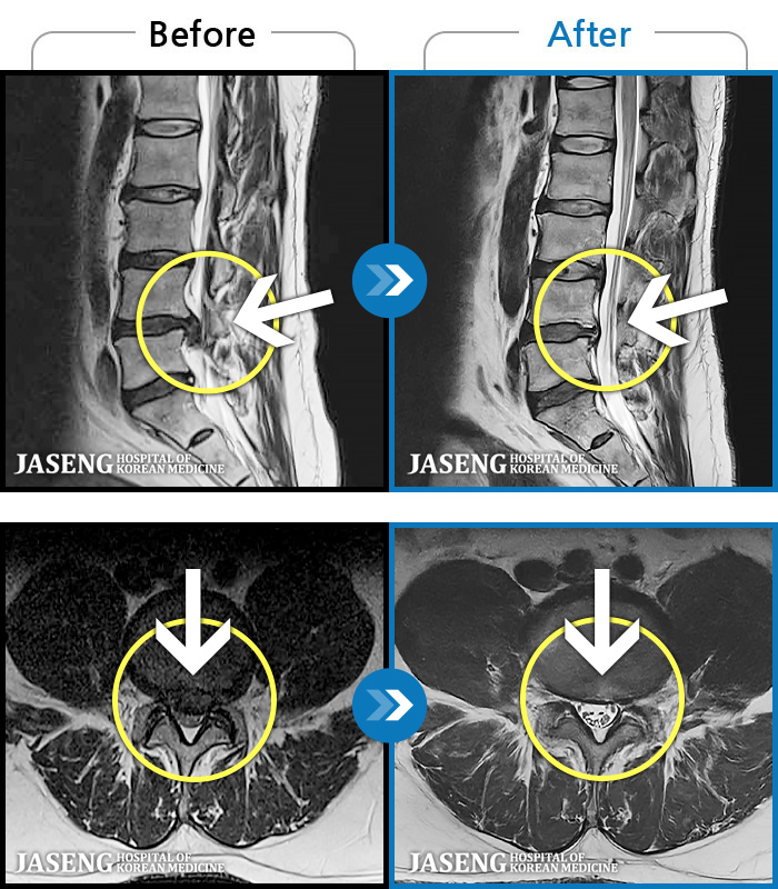 ڻѹ溴 ġ MRI  ġ- ο ߰  .