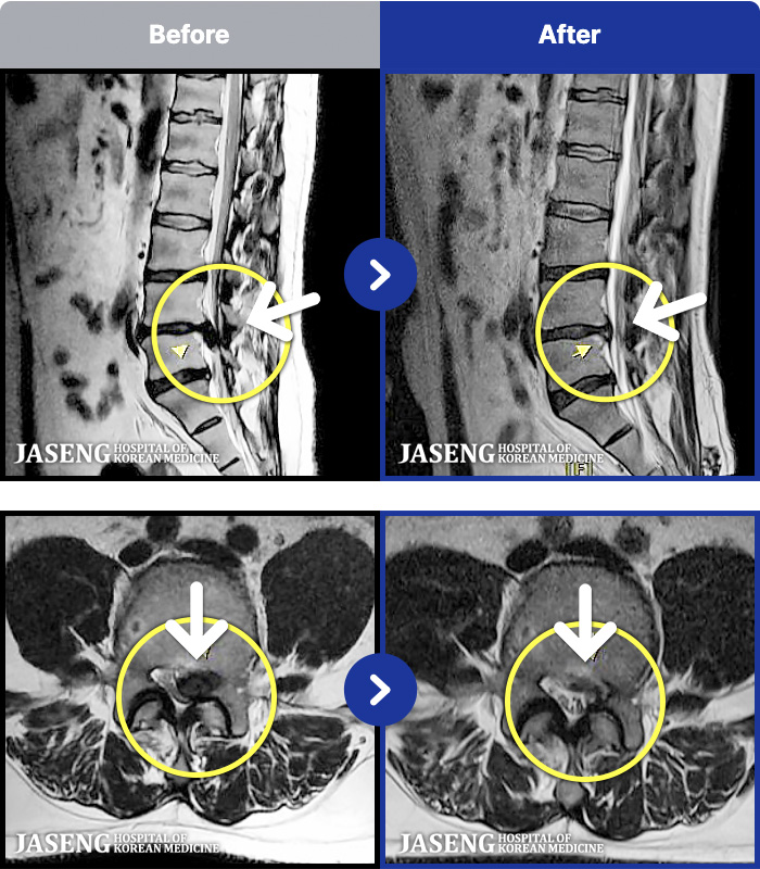 �����ڻ��ѹ溴�� ġ���� MRI�� ���� ġ����-�㸮 ������ ���� �кκ��� �����, �߸� ���� ������ �������� �����ϼ̽��ϴ�.