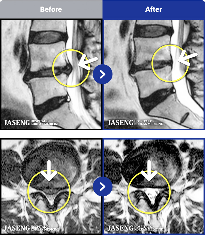 �ڻ��ѹ溴�� ġ���� MRI�� ���� ġ����-�ؽ��� ����� ���� ���� ��������� ���� ��ð� �ɾ� �ְų� �� �ִ� �ڼ� ������ ����� ���¿���.