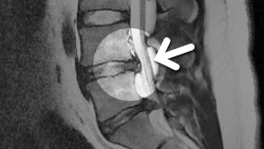 MRI  2