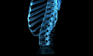 광화문자생한방병원 허리질환 척추전만증-정상적인 사람의 척추 모습입니다.
