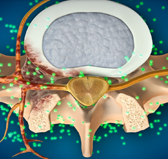 광화문자생한방병원 허리치료법 신경근회복술-신경근회복술의 특징 세번째 관련 사진 입니다.